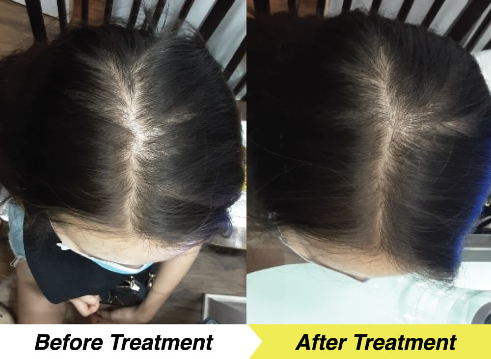 en-treatment-1