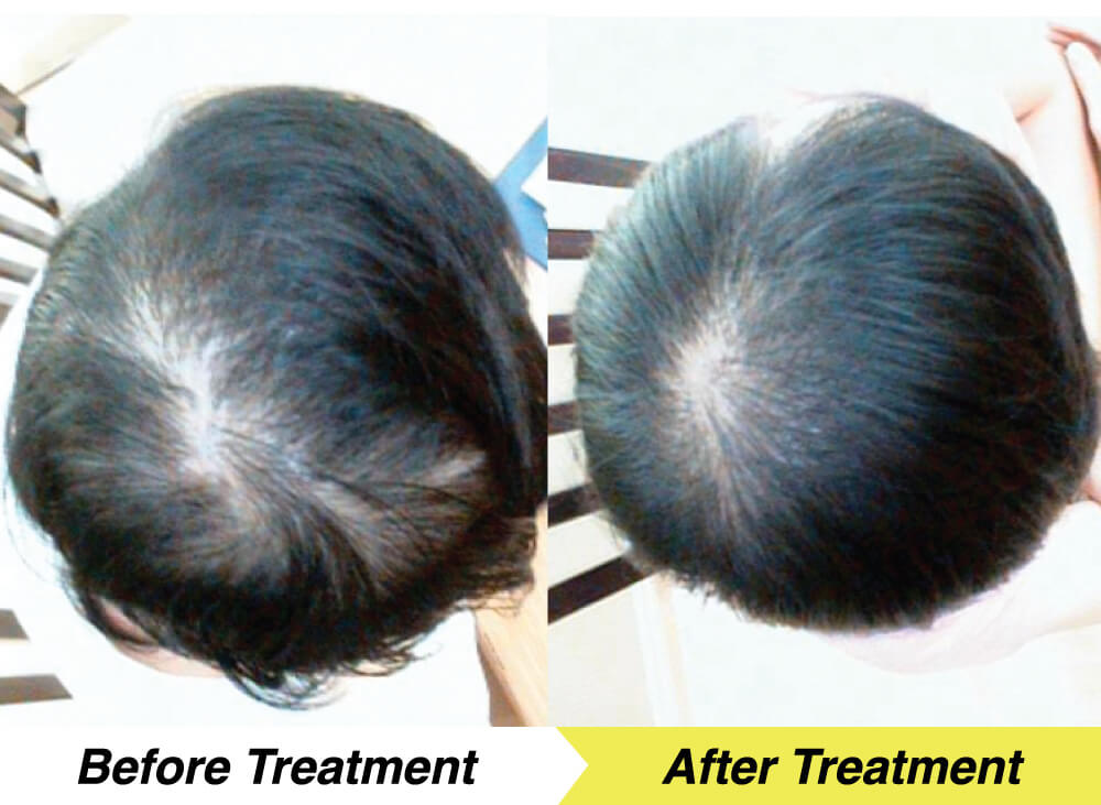 en-treatment-2