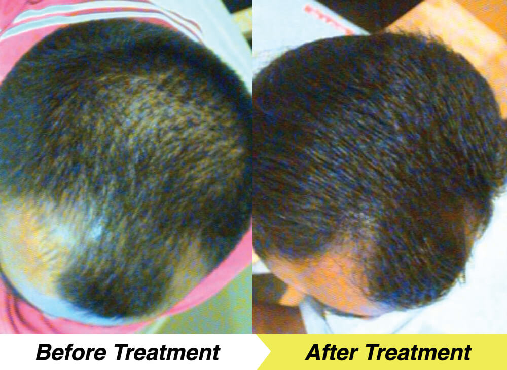 en-treatment-3