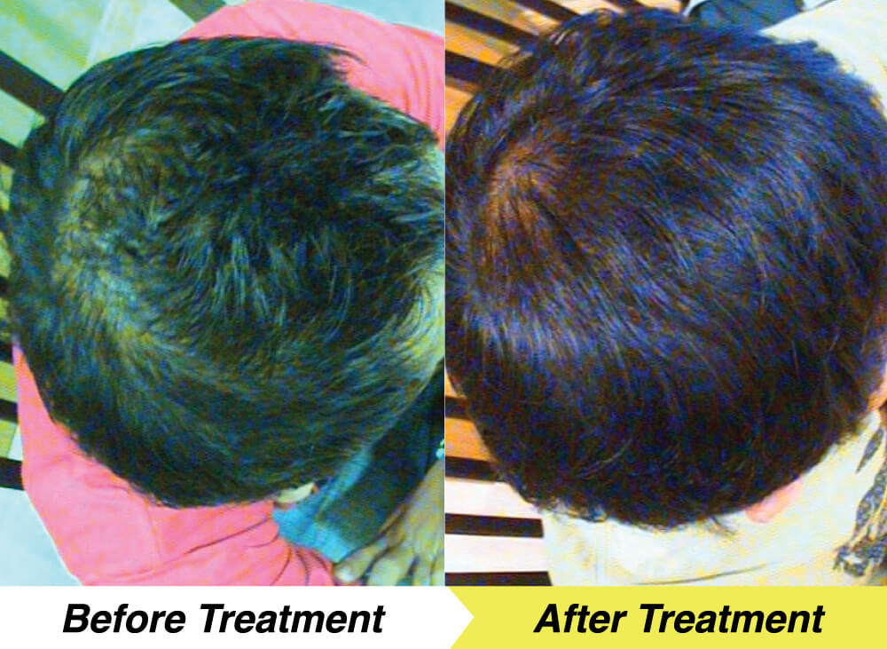 en-treatment-4