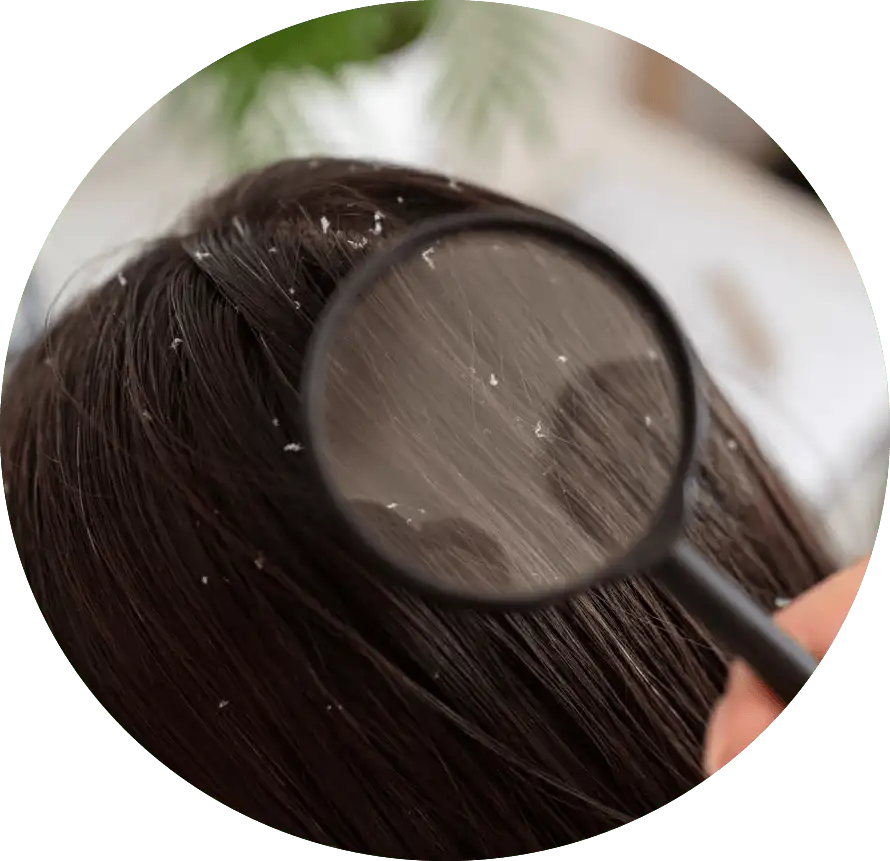 Instant Scalp Report – to Your Phone